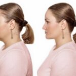 Neck fat lose before and after, showing a woman how to lose neck fat