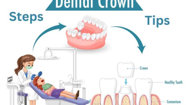 Loose Crown Treatment