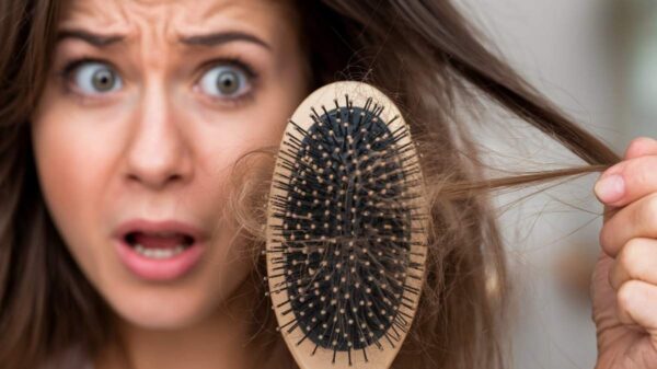 Woman Looking Shocked While Holding A Hairbrush With Strands Of Hair, Indicating Hair Loss Problem.