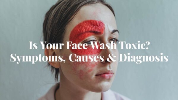 Is Your Face Wash Toxic Symptoms, Causes &Amp; Diagnosis