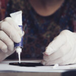 How to Remove Super Glue from Skin Safely: Best Methods & Tips 8 How to Remove Super Glue from Skin