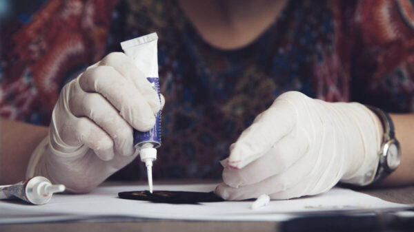 How to Remove Super Glue from Skin Safely: Best Methods & Tips 15 How to Remove Super Glue from Skin