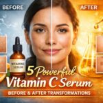 5 Powerful Vitamin C Serum Before and After Transformations 6 Vitamin C serum before and after