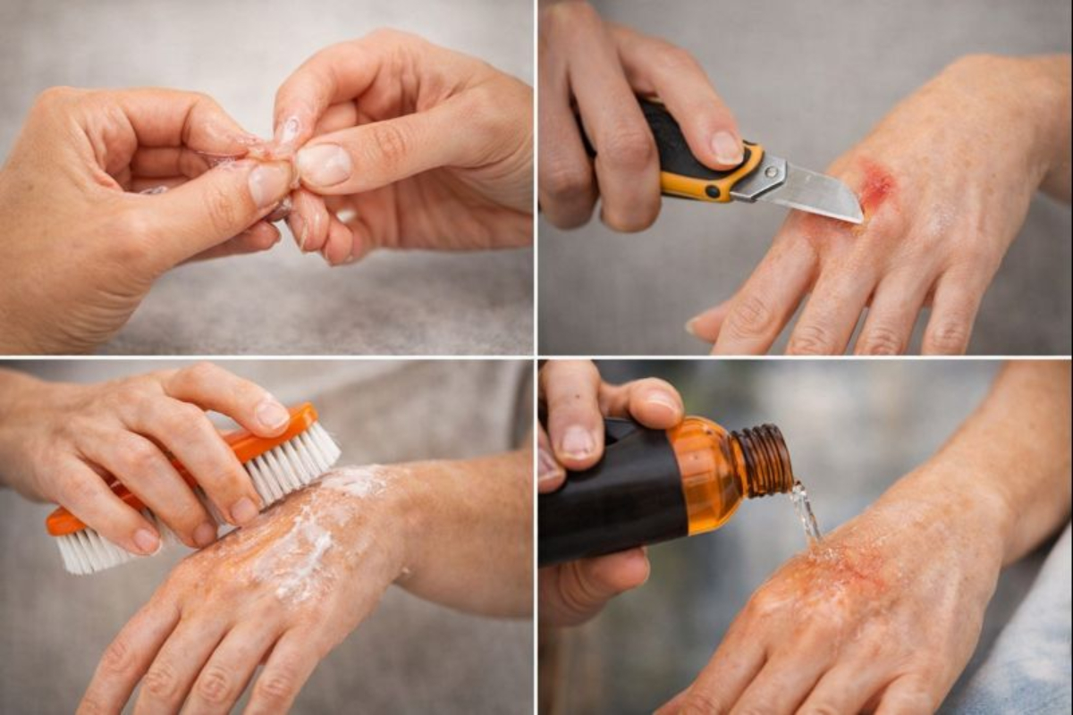 Avoid Common Mistakes While Removing Glue From Skin