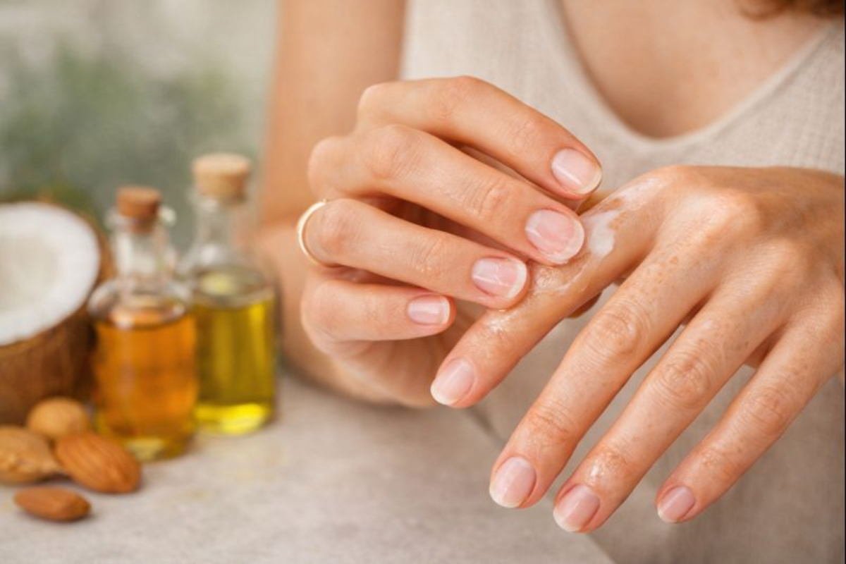 Natural Oils To Remove Glue From Skin
